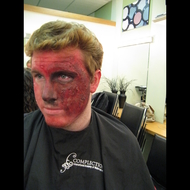 Flash Burn - Pro Image & Hair Design - Barrie